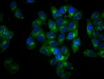 Phospho-LAT (Tyr191) Antibody in Immunocytochemistry (ICC/IF)