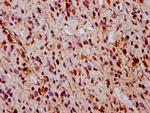 Phospho-ERK1/ERK2 (Thr185, Thr202) Antibody in Immunohistochemistry (Paraffin) (IHC (P))