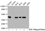 Phospho-ERK1/ERK2 (Thr185, Tyr187, Thr202, Tyr204) Antibody in Western Blot (WB)