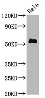 Phospho-c-Myc (Ser62) Antibody in Western Blot (WB)