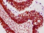 Phospho-RNA pol II CTD (Ser2) Antibody in Immunohistochemistry (Paraffin) (IHC (P))