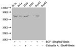 Phospho-Paxillin (Tyr118) Antibody in Western Blot (WB)