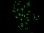 Phospho-c-Raf (Ser621) Antibody in Immunocytochemistry (ICC/IF)