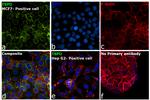 TSPO Antibody