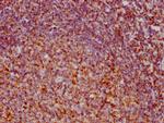 VDAC Antibody in Immunohistochemistry (Paraffin) (IHC (P))