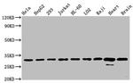 VDAC Antibody in Western Blot (WB)