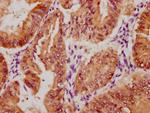 Phospho-YAP1 (Ser127) Antibody in Immunohistochemistry (Paraffin) (IHC (P))