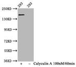 Phospho-SMC1 (Ser957) Antibody in Western Blot (WB)