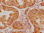 BAK Antibody in Immunohistochemistry (Paraffin) (IHC (P))