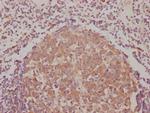 BAK Antibody in Immunohistochemistry (Paraffin) (IHC (P))