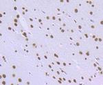 RbAp48 Antibody in Immunohistochemistry (Paraffin) (IHC (P))