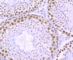 RbAp48 Antibody in Immunohistochemistry (Paraffin) (IHC (P))