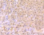 Cullin 4A Antibody in Immunohistochemistry (Paraffin) (IHC (P))