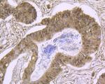 Cullin 4A Antibody in Immunohistochemistry (Paraffin) (IHC (P))