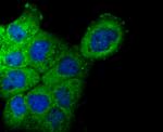 NCK1 Antibody in Immunocytochemistry (ICC/IF)