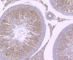 NCK1 Antibody in Immunohistochemistry (Paraffin) (IHC (P))