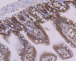 PTBP1 Antibody in Immunohistochemistry (Paraffin) (IHC (P))