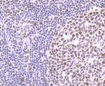 PTBP1 Antibody in Immunohistochemistry (Paraffin) (IHC (P))