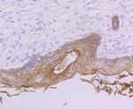 PERP Antibody in Immunohistochemistry (Paraffin) (IHC (P))