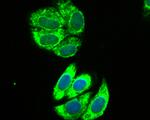 IL13RA1 Antibody in Immunocytochemistry (ICC/IF)