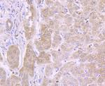 IL13RA1 Antibody in Immunohistochemistry (Paraffin) (IHC (P))