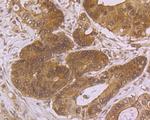 Villin Antibody in Immunohistochemistry (Paraffin) (IHC (P))