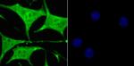 GLO1 Antibody in Immunocytochemistry (ICC/IF)