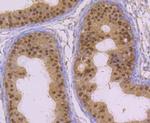 GLO1 Antibody in Immunohistochemistry (Paraffin) (IHC (P))