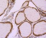 GLO1 Antibody in Immunohistochemistry (Paraffin) (IHC (P))