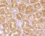 ADAR1 Antibody in Immunohistochemistry (Paraffin) (IHC (P))