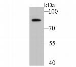 BDKRB2 Antibody in Western Blot (WB)