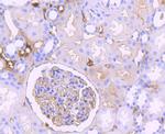 Complement C3 Antibody in Immunohistochemistry (Paraffin) (IHC (P))