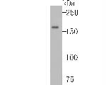 Complement C3 Antibody in Western Blot (WB)