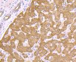 PCK1 Antibody in Immunohistochemistry (Paraffin) (IHC (P))