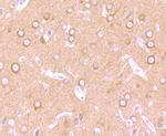 CRMP1 Antibody in Immunohistochemistry (Paraffin) (IHC (P))