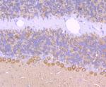 CRMP1 Antibody in Immunohistochemistry (Paraffin) (IHC (P))