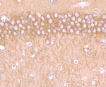 CRMP1 Antibody in Immunohistochemistry (Paraffin) (IHC (P))