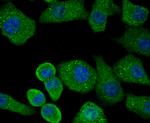 PRKD2 Antibody in Immunocytochemistry (ICC/IF)