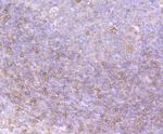 PRKD2 Antibody in Immunohistochemistry (Paraffin) (IHC (P))