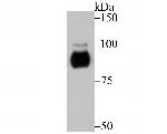 PRKD2 Antibody in Western Blot (WB)