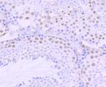 DKC1 Antibody in Immunohistochemistry (Paraffin) (IHC (P))