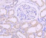 DKC1 Antibody in Immunohistochemistry (Paraffin) (IHC (P))