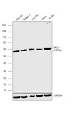 DKC1 Antibody in Western Blot (WB)