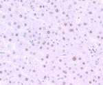 MATR3 Antibody in Immunohistochemistry (Paraffin) (IHC (P))