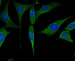 PFKM Antibody in Immunocytochemistry (ICC/IF)