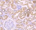 PFKM Antibody in Immunohistochemistry (Paraffin) (IHC (P))