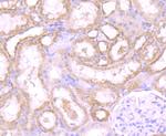 PSME1 Antibody in Immunohistochemistry (Paraffin) (IHC (P))