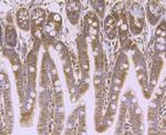 VPS35 Antibody in Immunohistochemistry (Paraffin) (IHC (P))