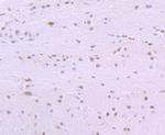 SF3B1 Antibody in Immunohistochemistry (Paraffin) (IHC (P))