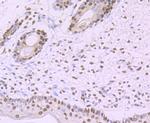 SF3B1 Antibody in Immunohistochemistry (Paraffin) (IHC (P))